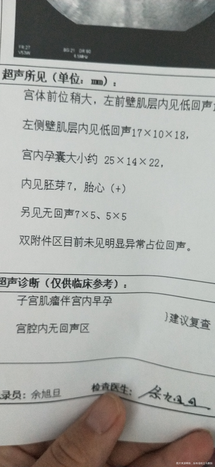 请帮忙看一下B 超单,详解并说明风险