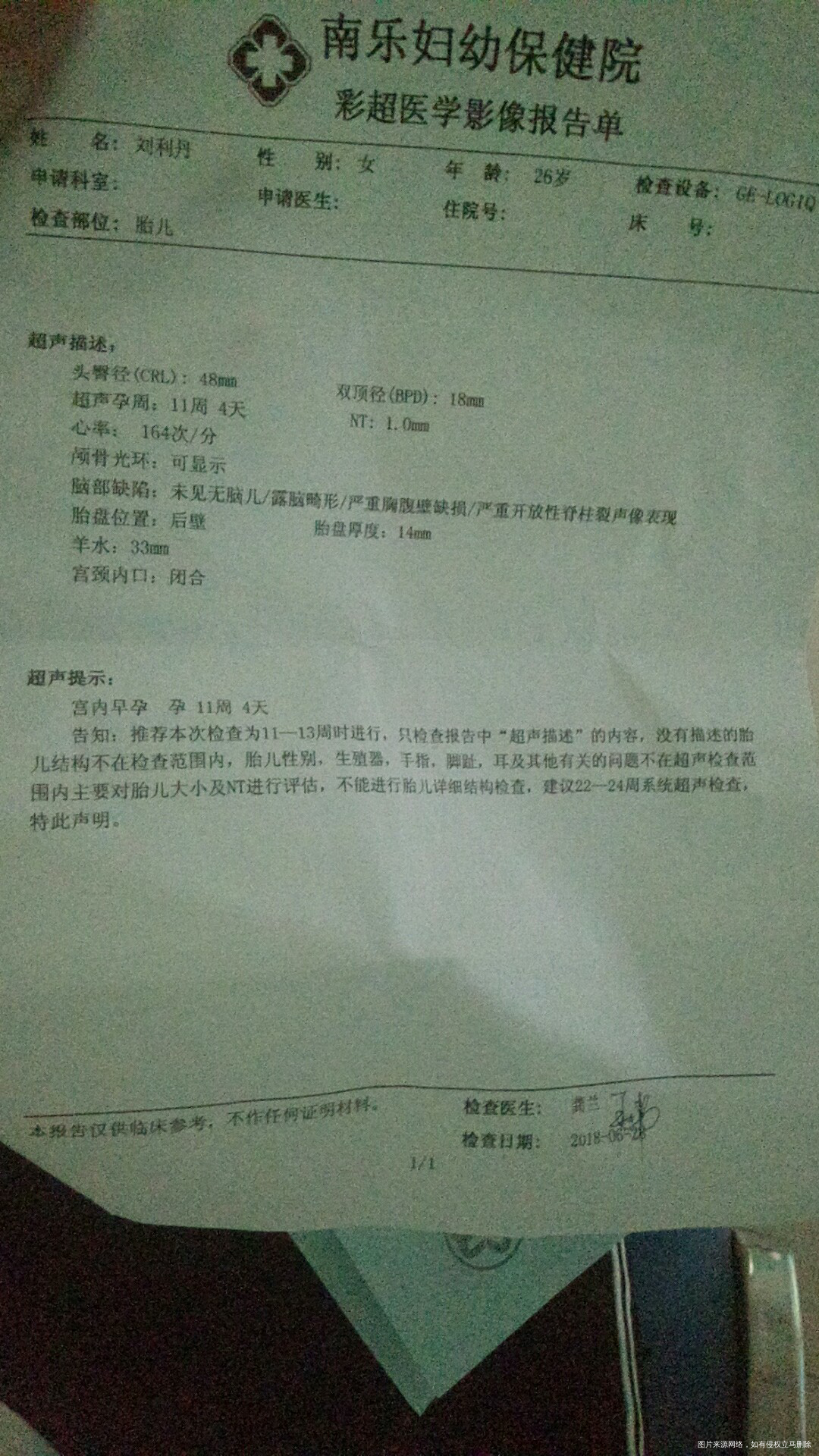 nt检查,医生帮忙看一下