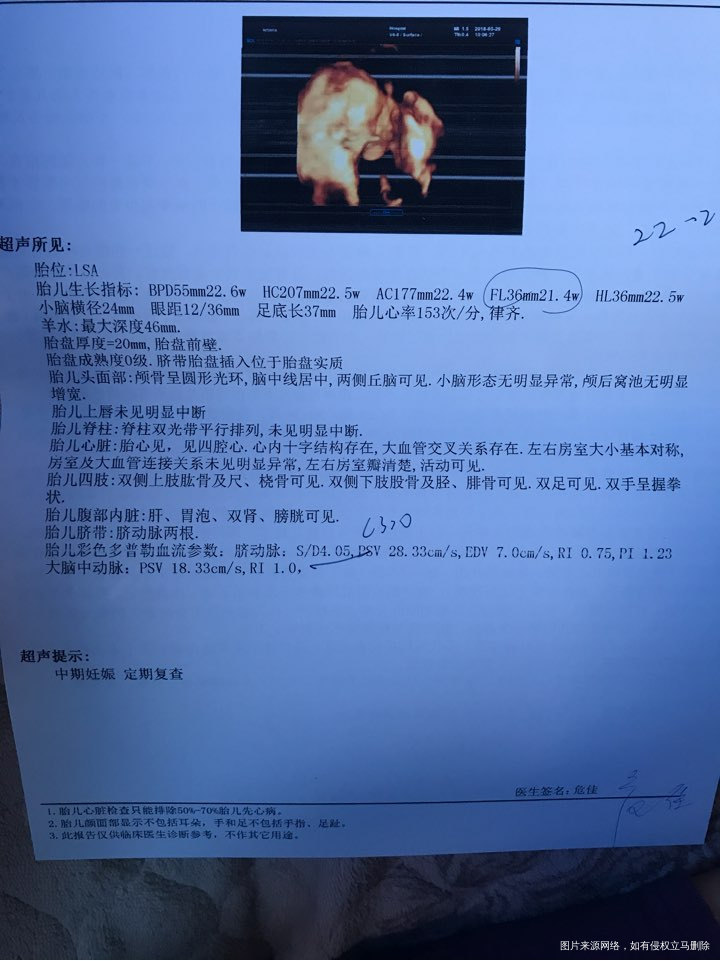 帮忙看看四维,谢谢。六一快乐