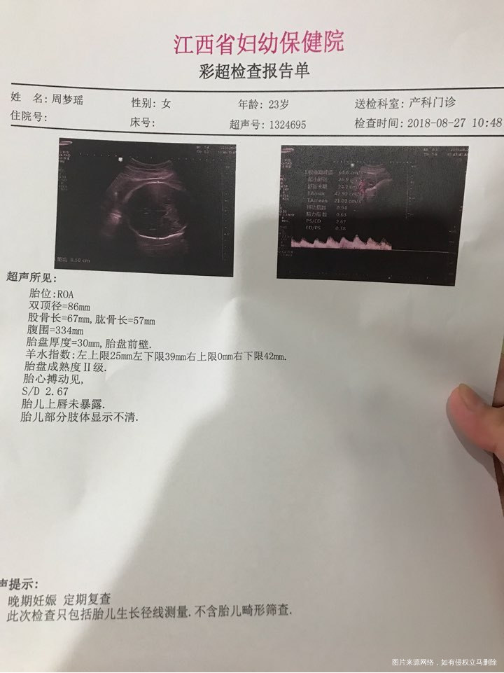 刚做完B超,忘记问医生了。