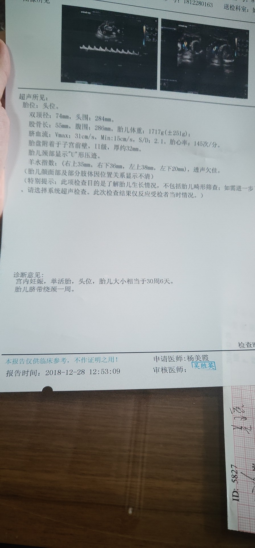 29周偏大两周正常吗？