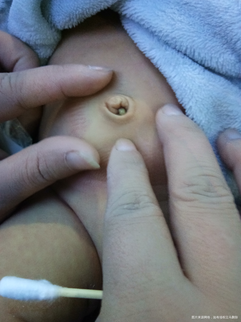 有医生在线么 急 宝宝24天了