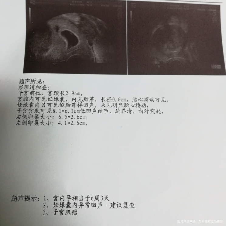 移植30天做b超检查结果