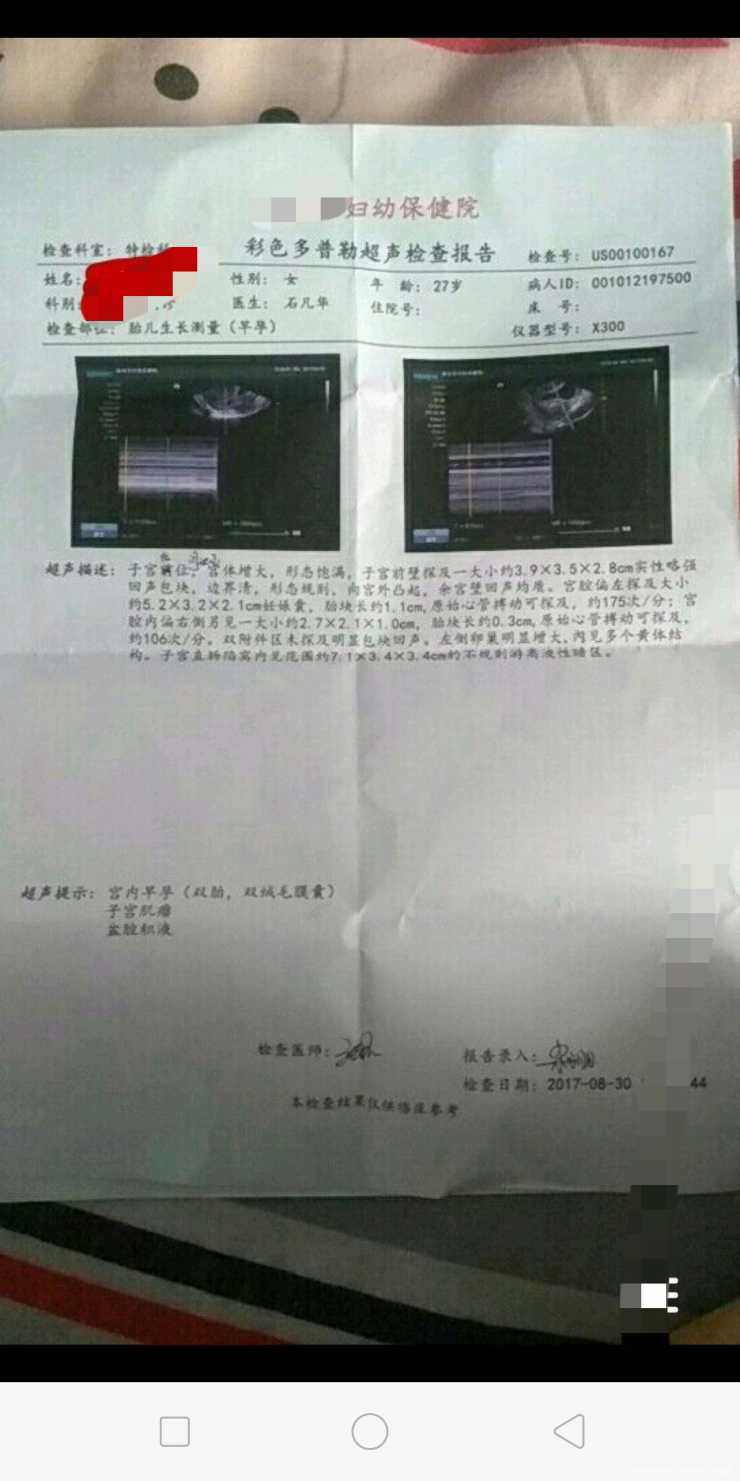 #与试管相关的照片#试管给了我希望,也没让我失望