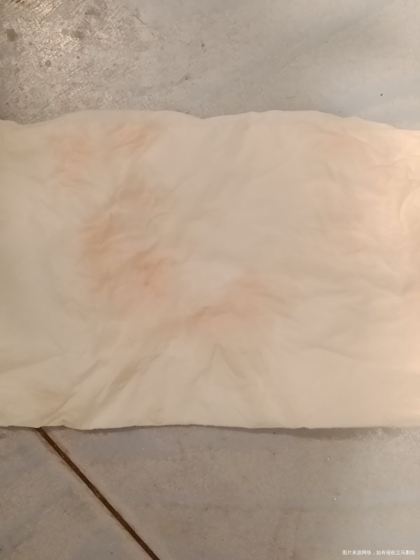 大姨妈走了俩天有淡血跟着尿出来正常吗?