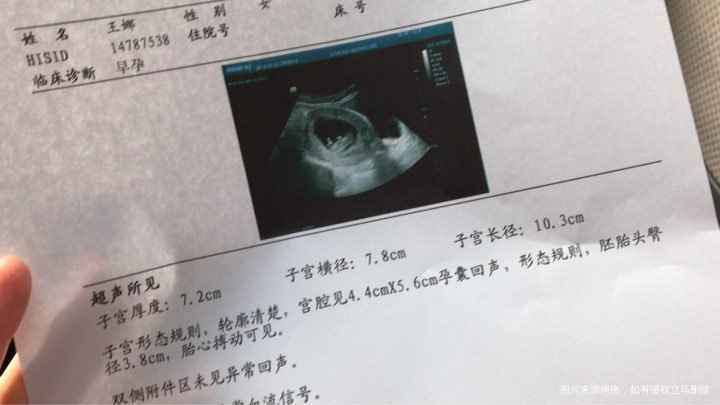 医生帮我看看我三超的单子