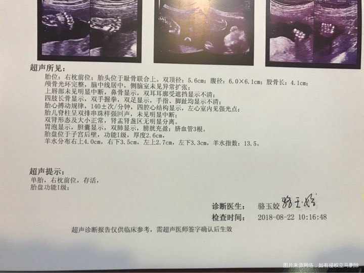 系统b超,怀孕23+1,麻烦看下是否正常?