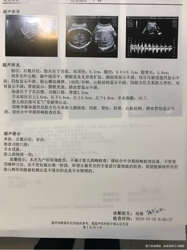 今天孕31周,帮忙看看b超结果