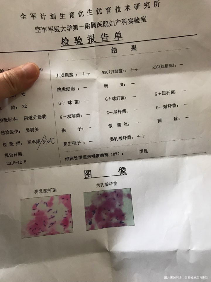 怀孕38周,住院前抽了一些血,麻烦看下结果