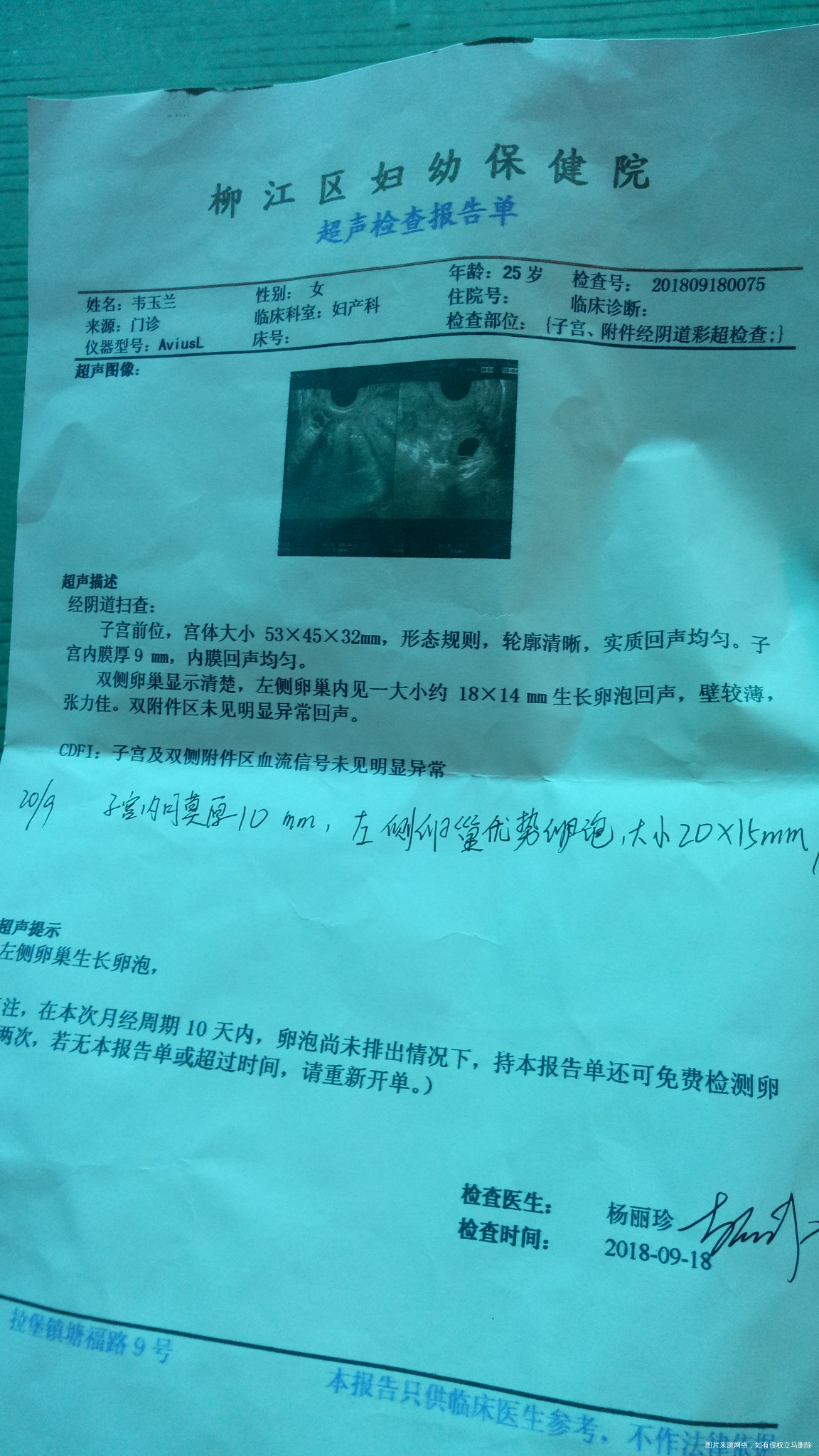 麻烦医生帮我看看这个卵泡,那么大还没有排?