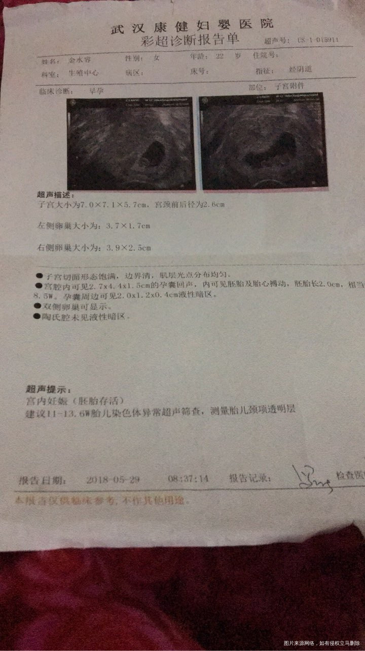 我怀啦 | 做试管一次就成功了,现在两个多月