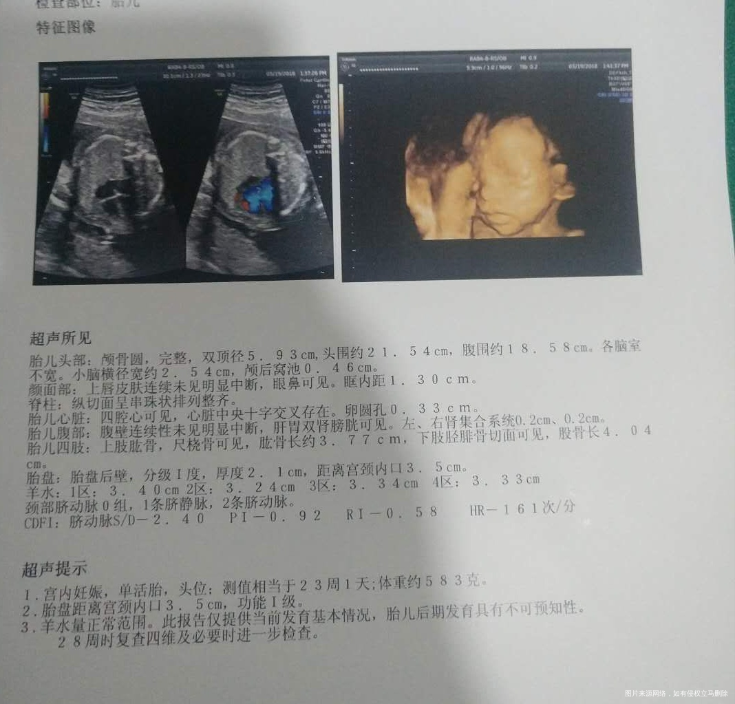 大家帮忙看看是男宝宝还是女宝宝