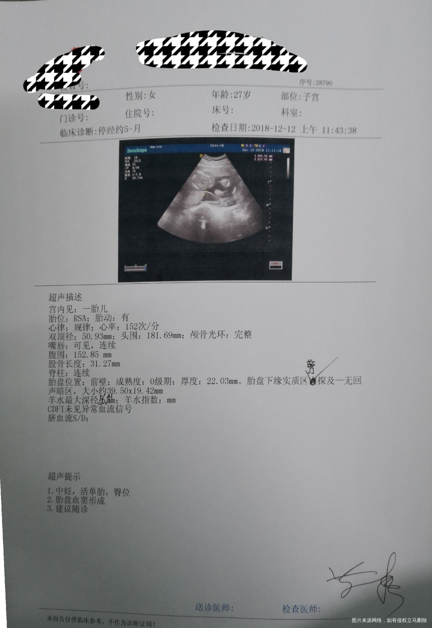 孕二十周两天的检查结果,请问我需要怎么做吗?