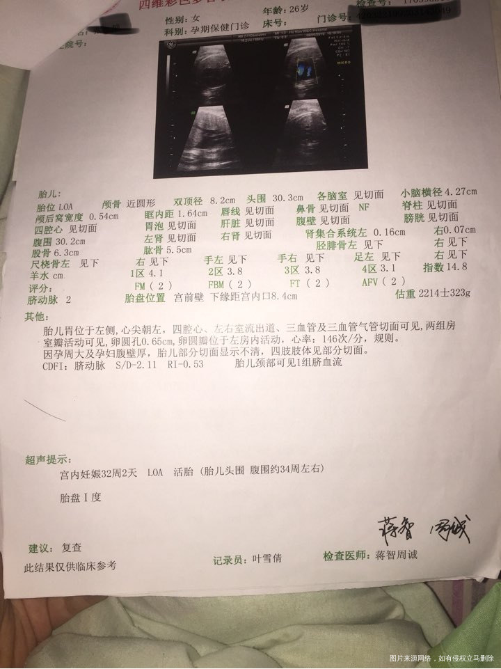 
32周加的四维彩超,还好一切都好,姐妹们有会看男女的吗?帮忙看看,现在买衣服都…