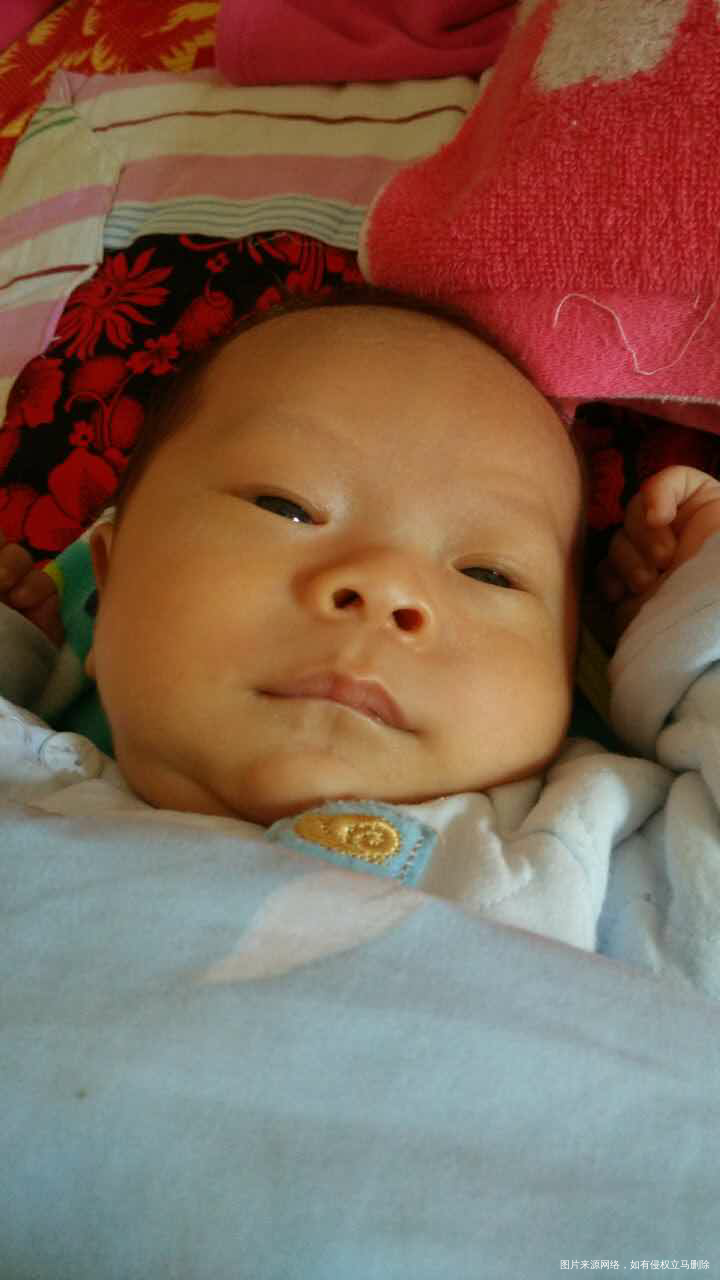 【宝宝黄疸】分清宝宝黄疸类型很重要