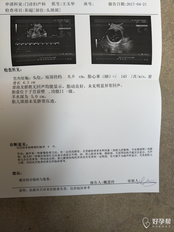孕31周,刚刚新鲜出炉的b超