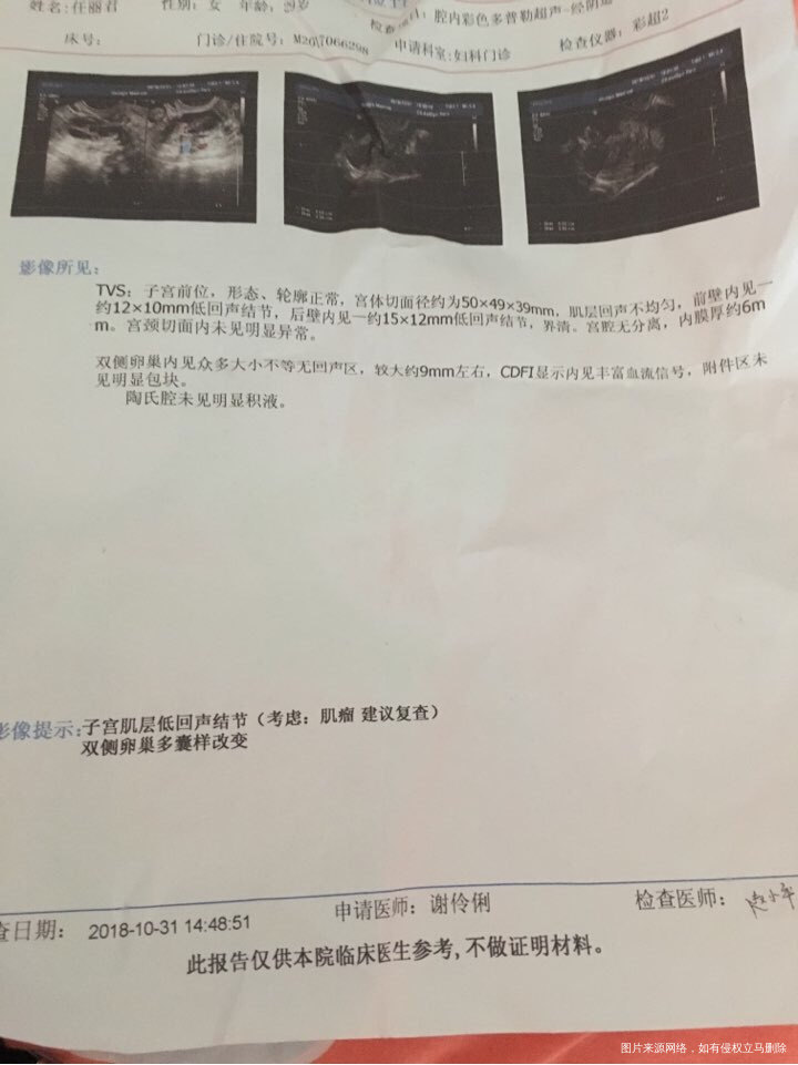 月经第18天了 卵泡发育的慢怎么办