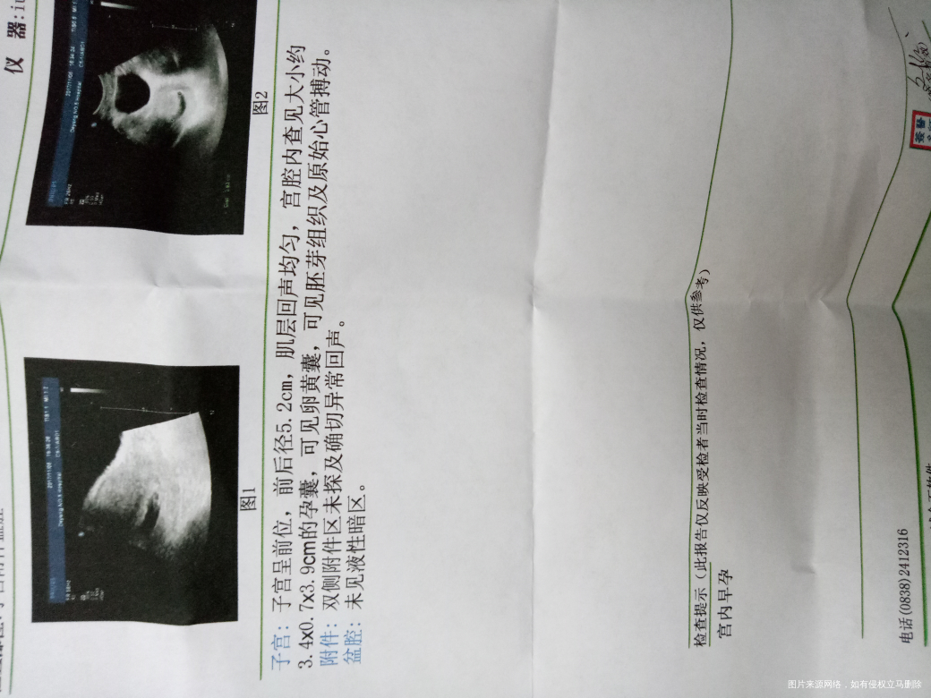 怀孕7周多,便秘严重怎么办