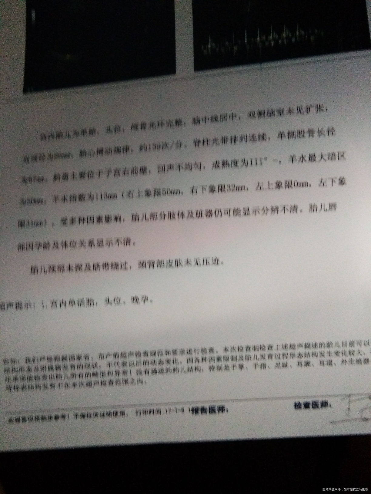 怀孕35+1了,今天去查,胎盘成熟度到了3级-了,正常吗?