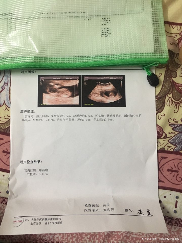 
今天刚做的NT,帮我看看正常吗?按软件上今天是12+4了,NT是12周?