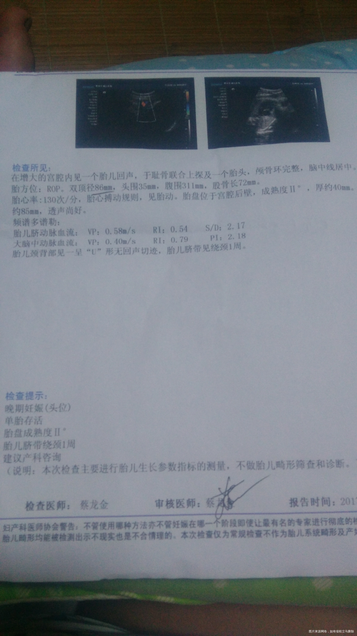 头小腿长是遗传还是营养不够