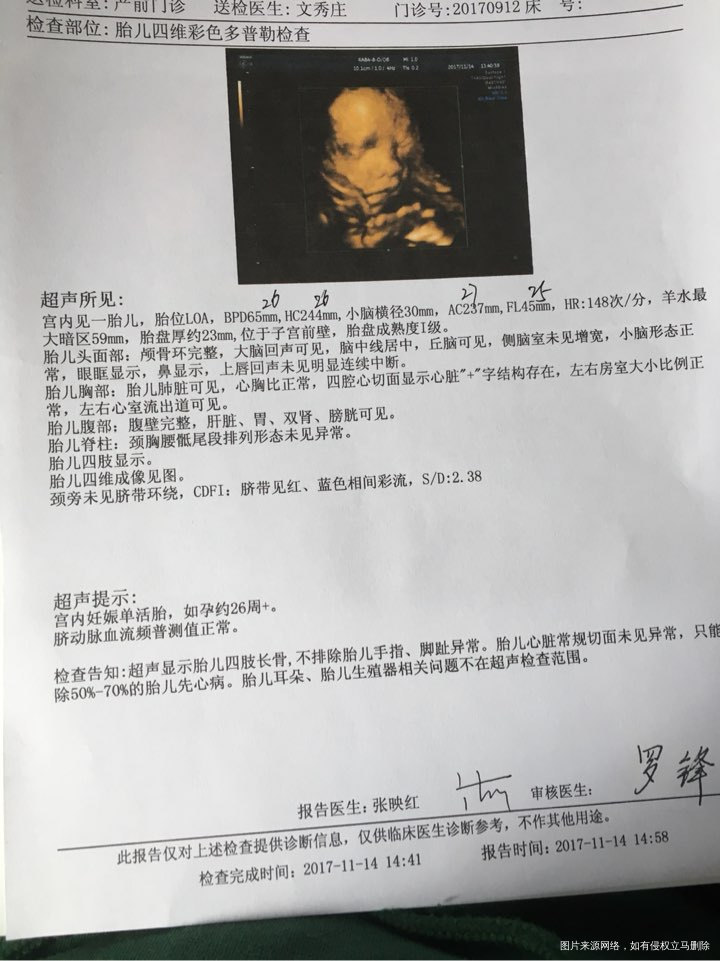 宝宝好棒,好配合,四维一次过