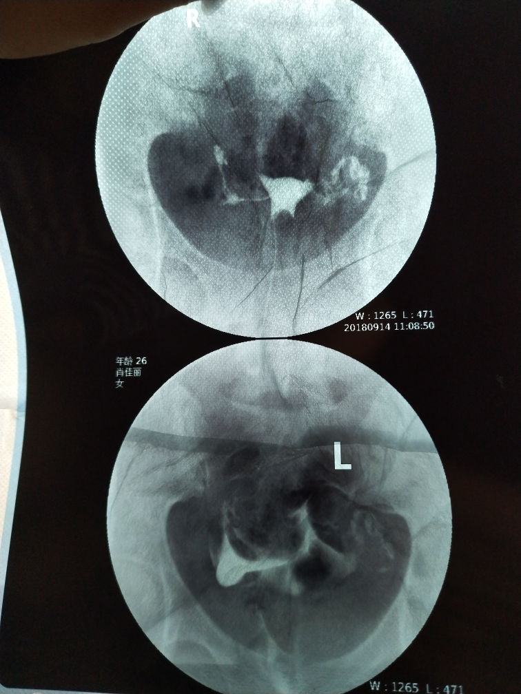 今天做了造影 医生帮我看下怎么样吧？