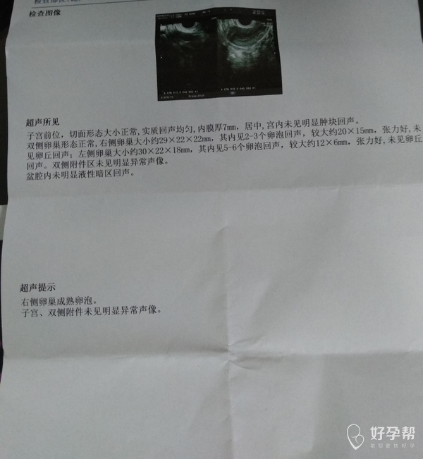正常的排卵日已经过了卵泡成熟未见卵丘