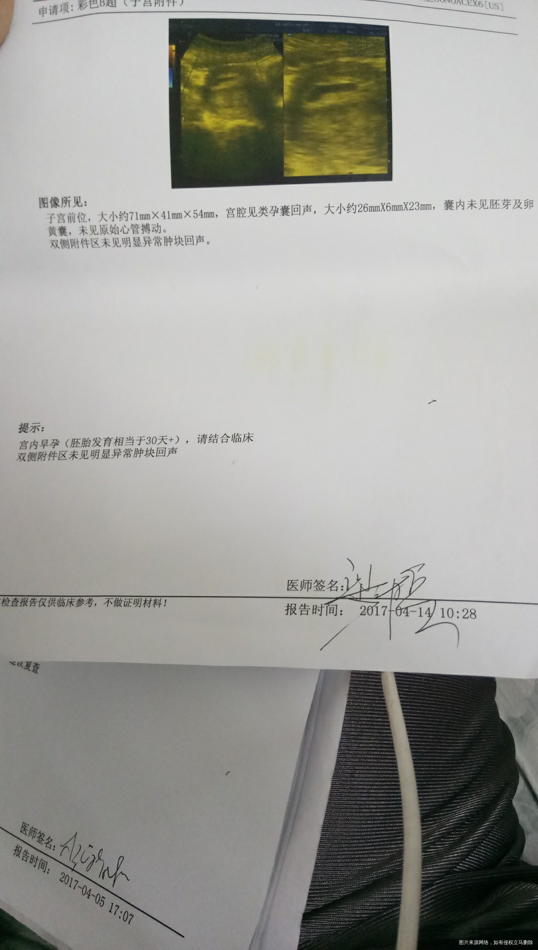 路过的医生帮忙麻烦看看