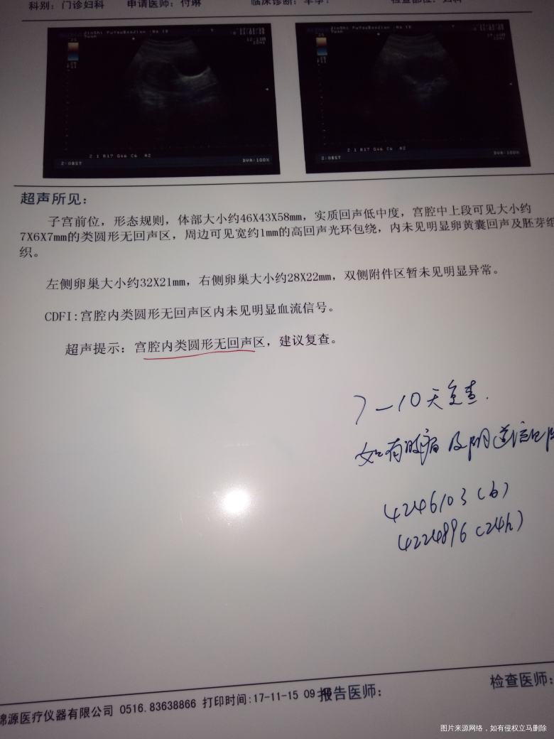 多囊自然怀孕孕酮偏低