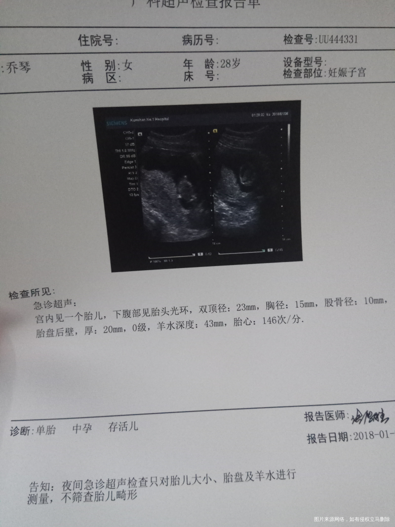 怀孕三个月,之前因为流过血住医院,