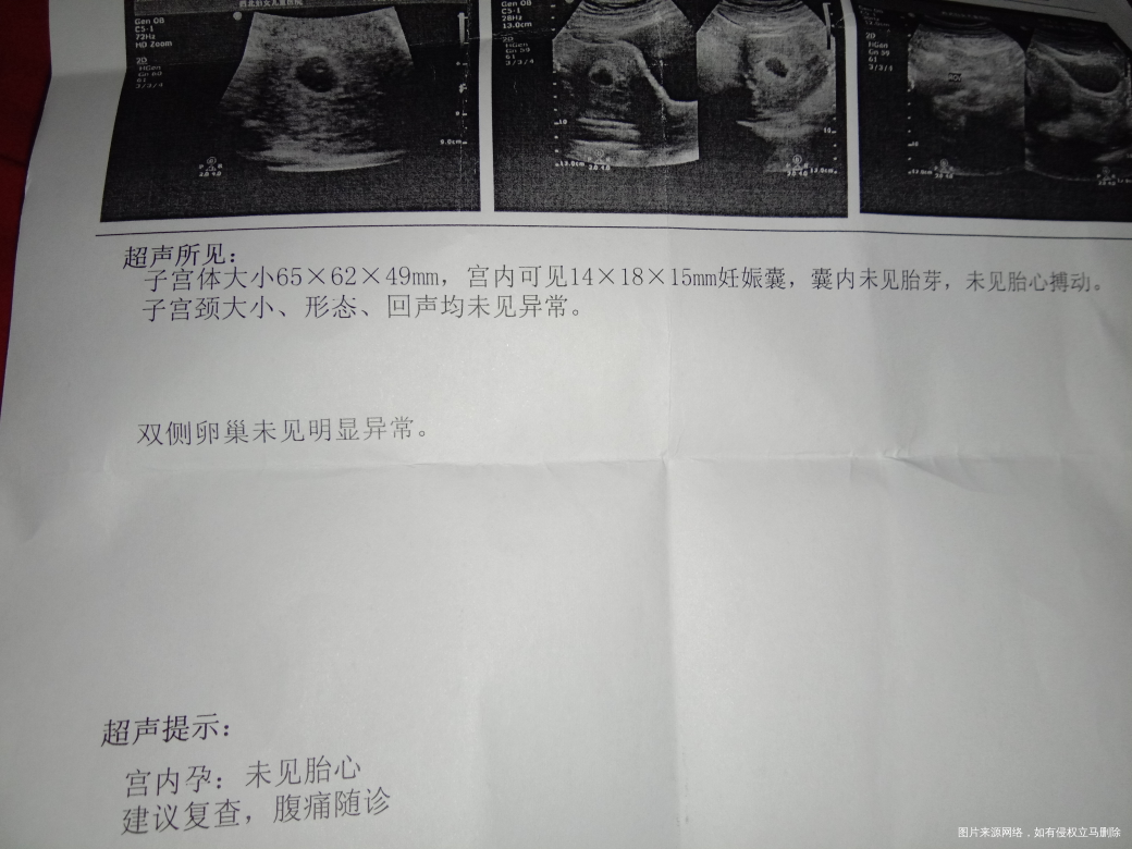 求助......求助,在线的医生帮忙看看