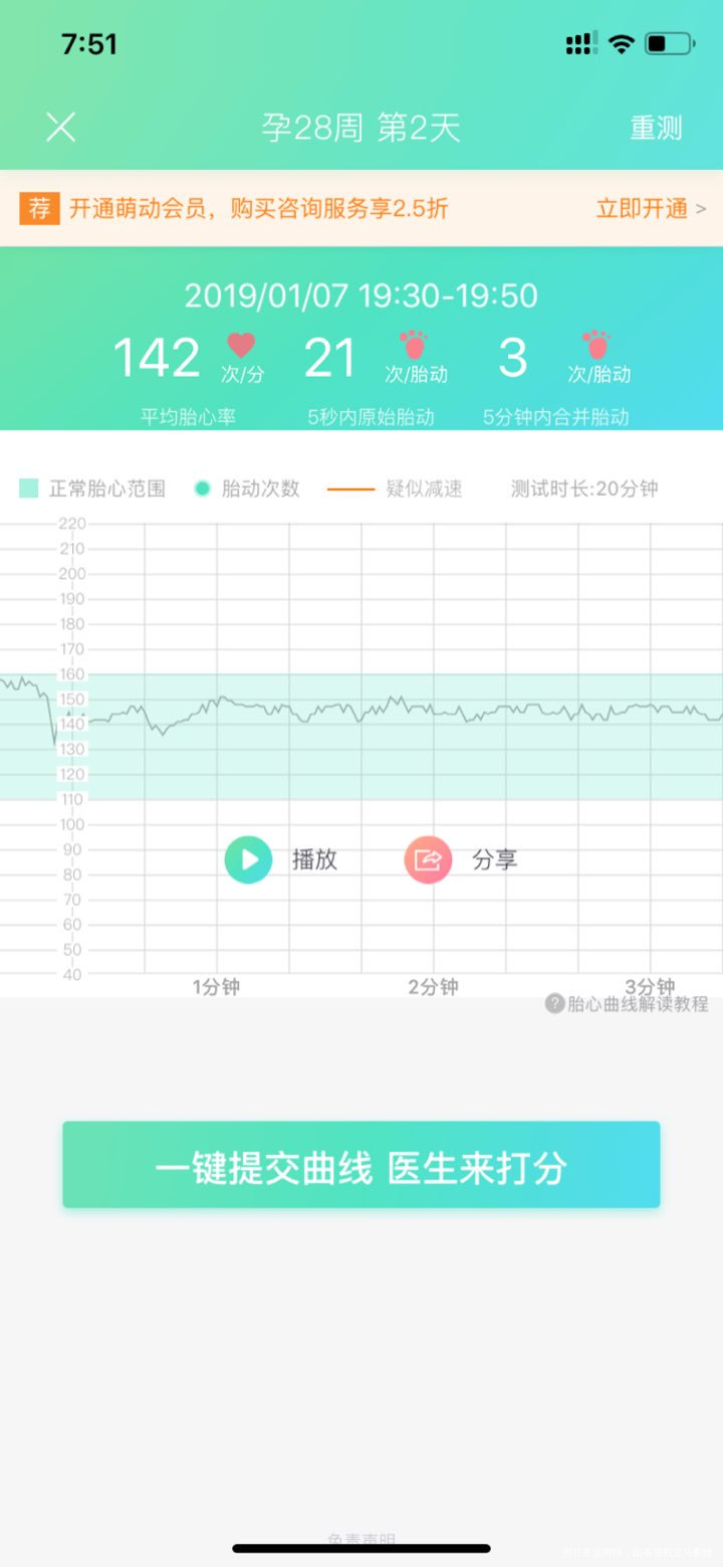 我用自己买的胎动仪器测的曲线