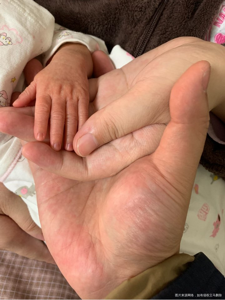 说说我的要人命的剖腹产吧!