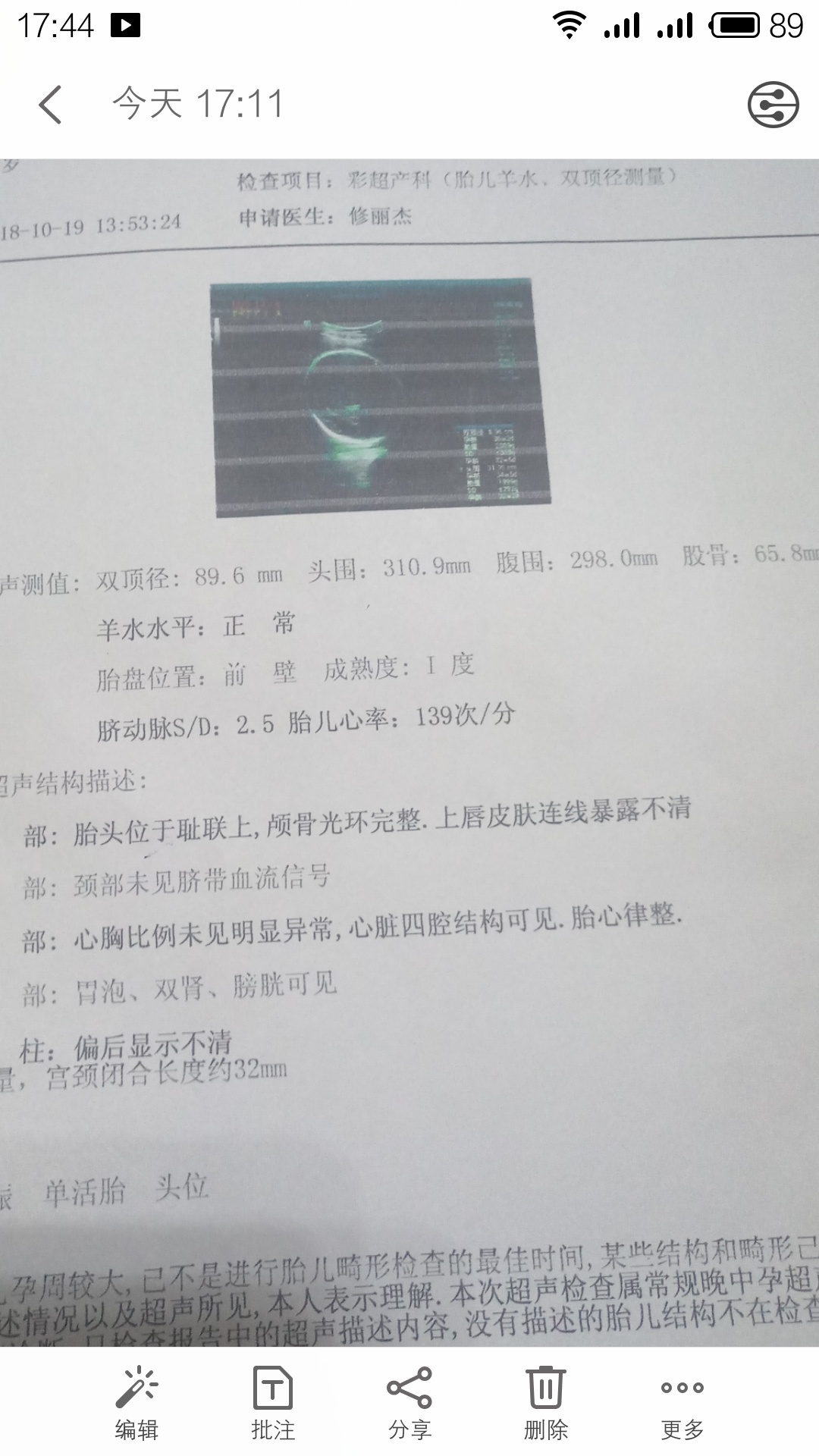 问问 帮忙算 帮忙算下 帮忙算下