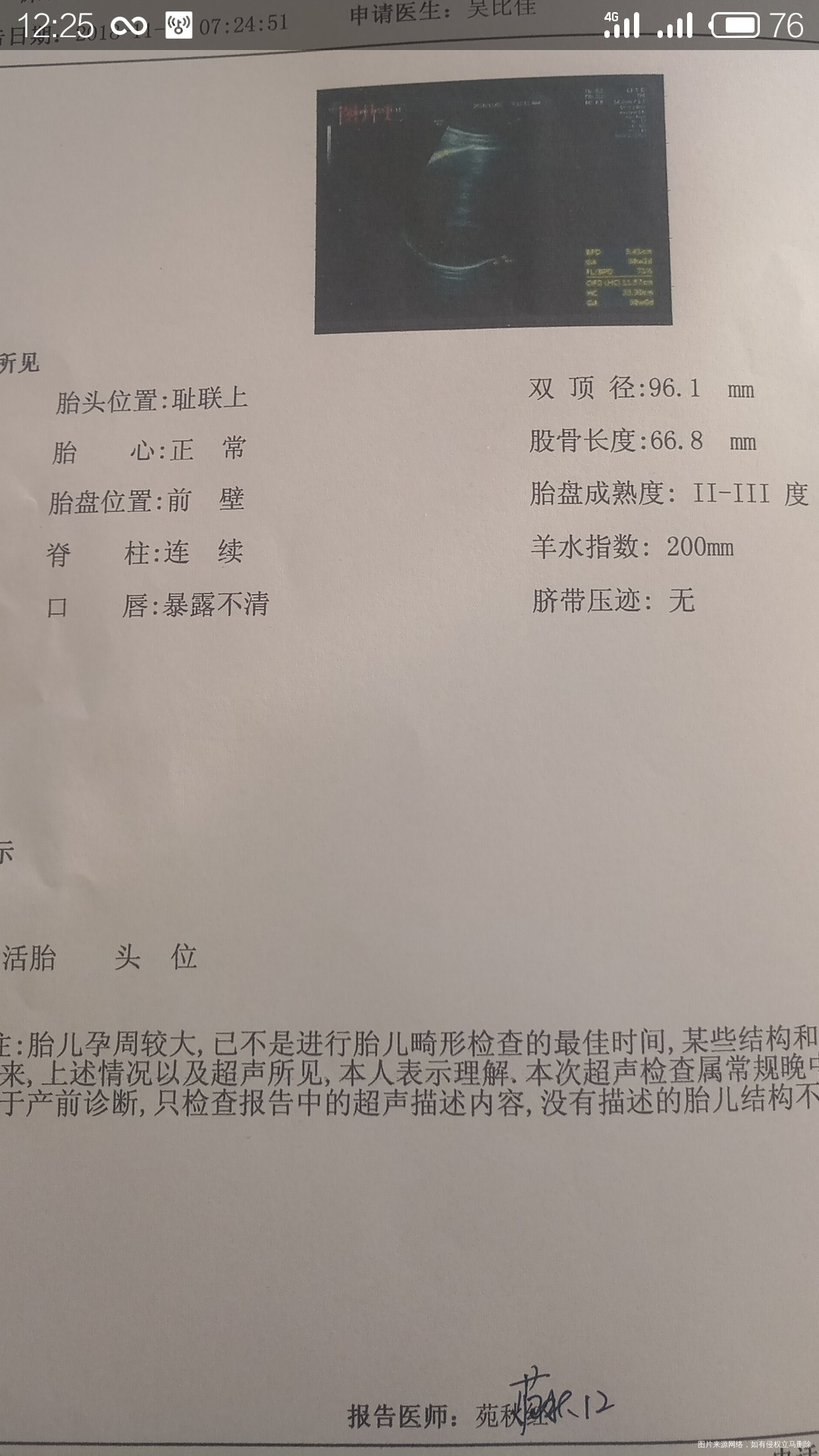 问问 我不会算下 帮忙算下