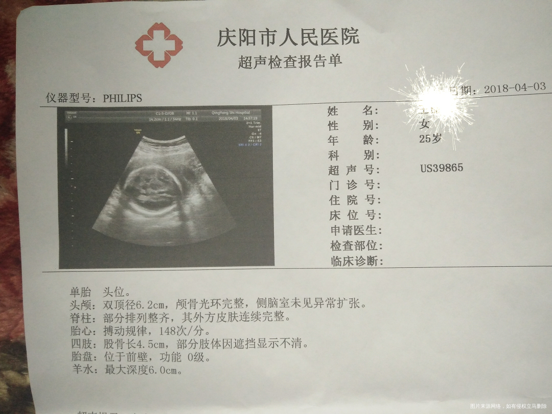 路过的医生麻烦帮我看看,各项都正常吗