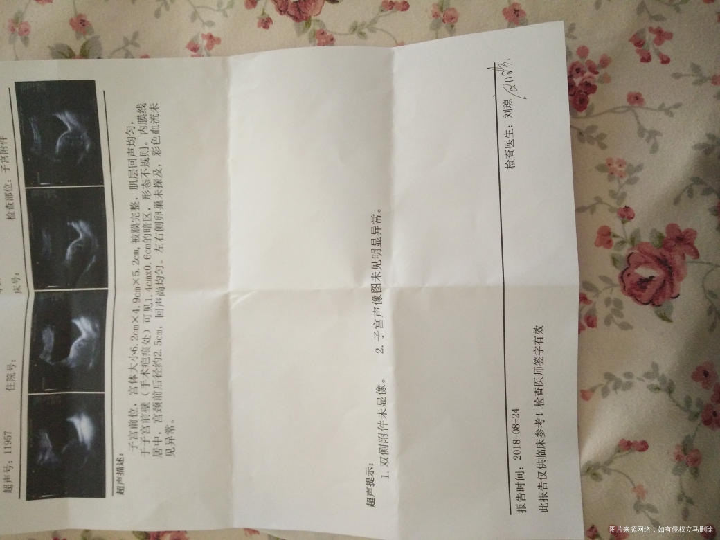 麻烦大夫帮我看看,谢谢了