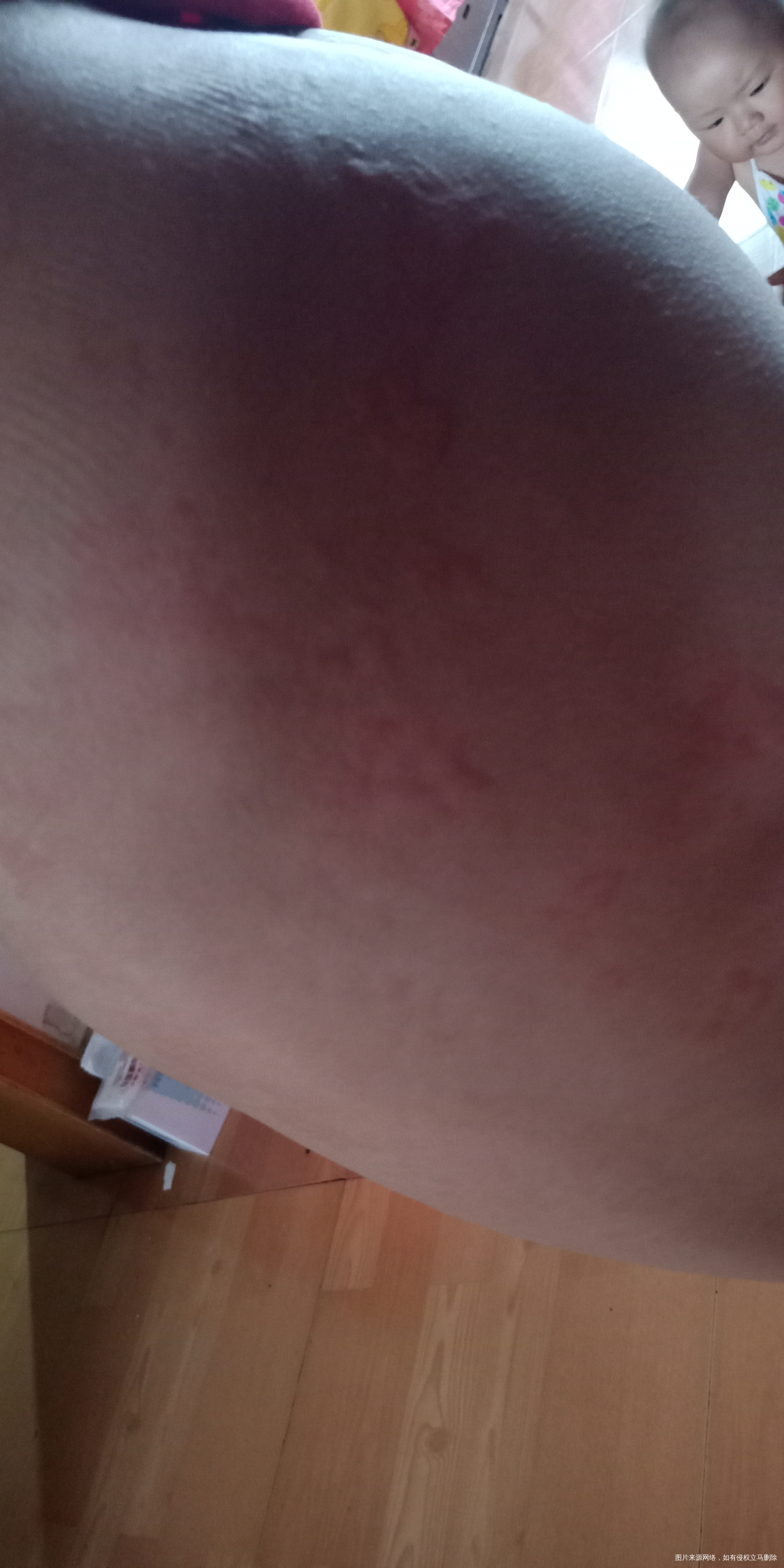 专家帮忙看看大宝是怎么回事?