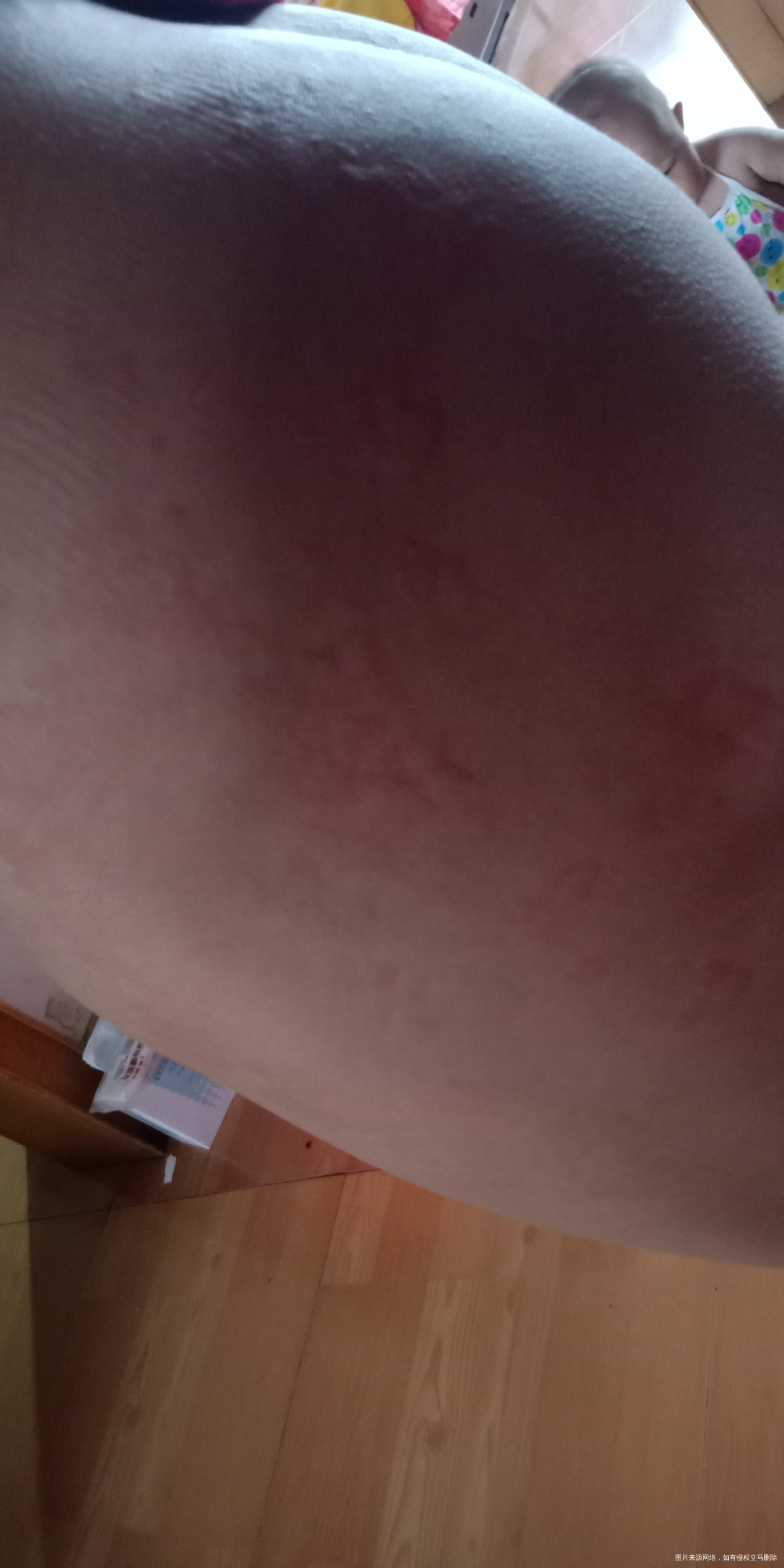 专家帮忙看看大宝是怎么回事?