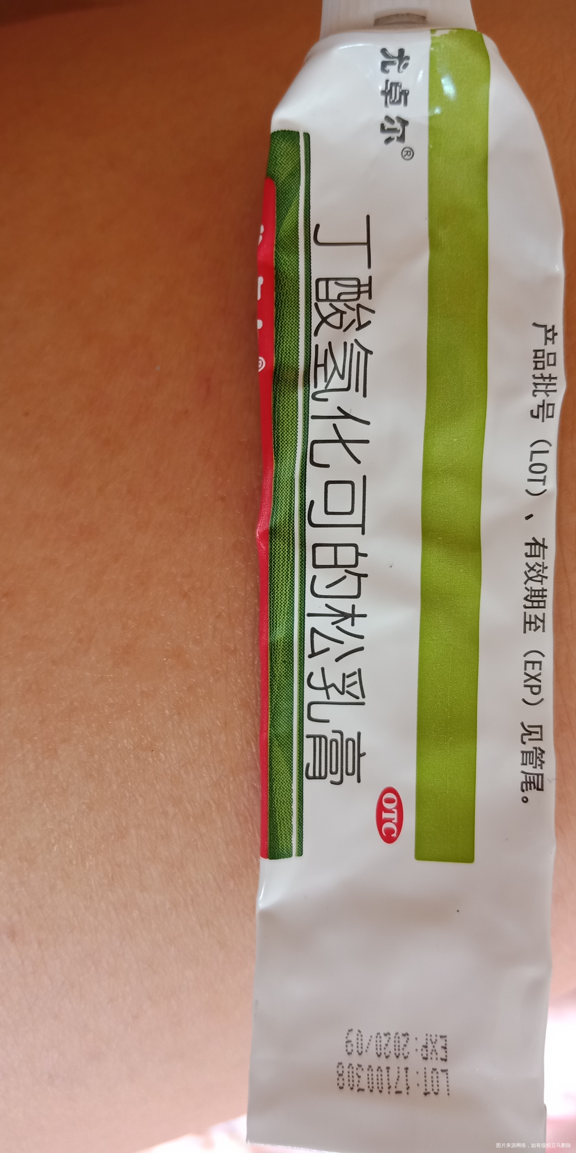 宝宝过敏严重该怎么办?