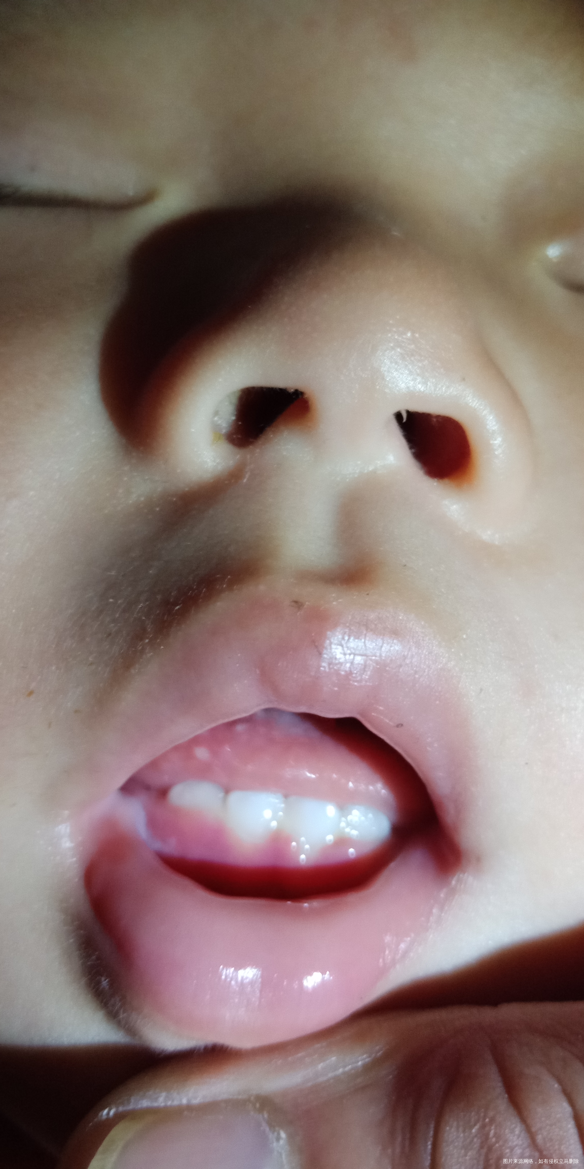 宝宝的舌头上这是什么?