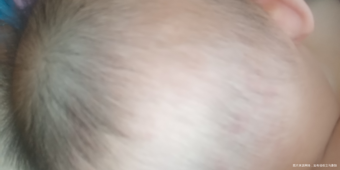 一生日的宝宝需要补钙吗?