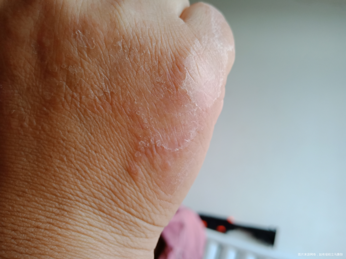 手上这是起的些啥子东西啊