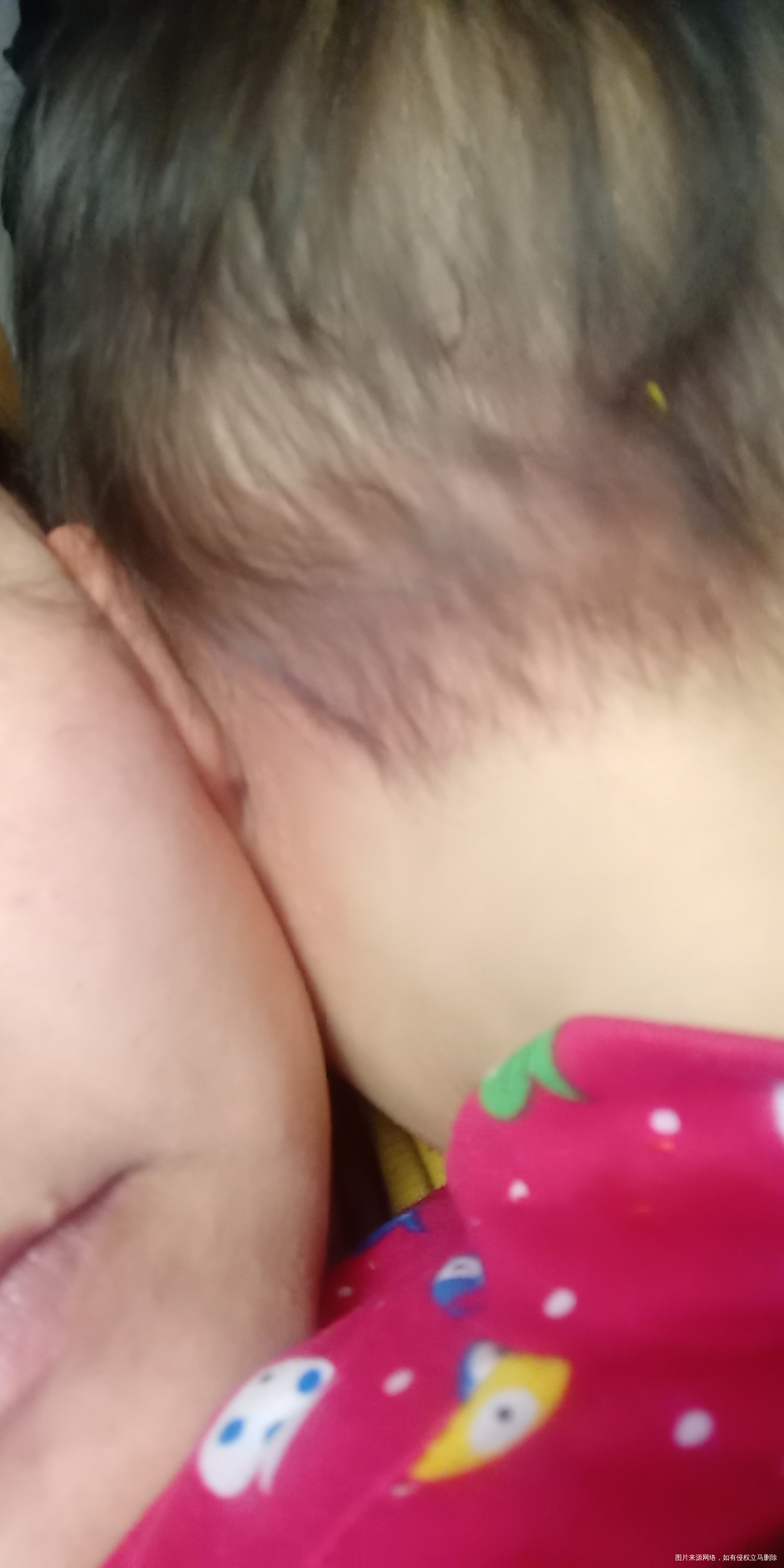 请教专家们关于过敏的问题