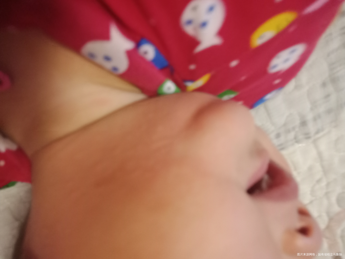 请教专家们关于过敏的问题