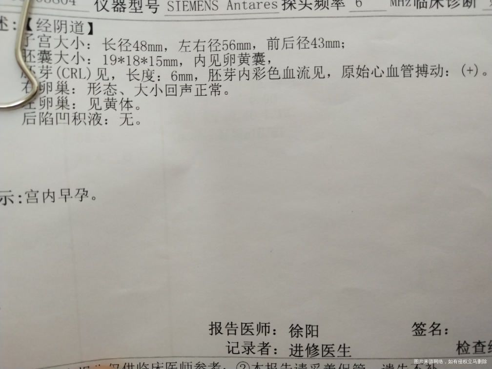 今天第45天,宝宝有胎心胎芽了。