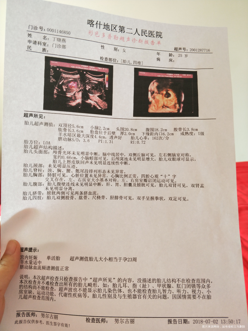 医生能不能帮我看看宝宝有多重了