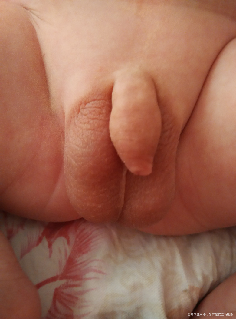 求助,医生,帮忙看看,谢谢