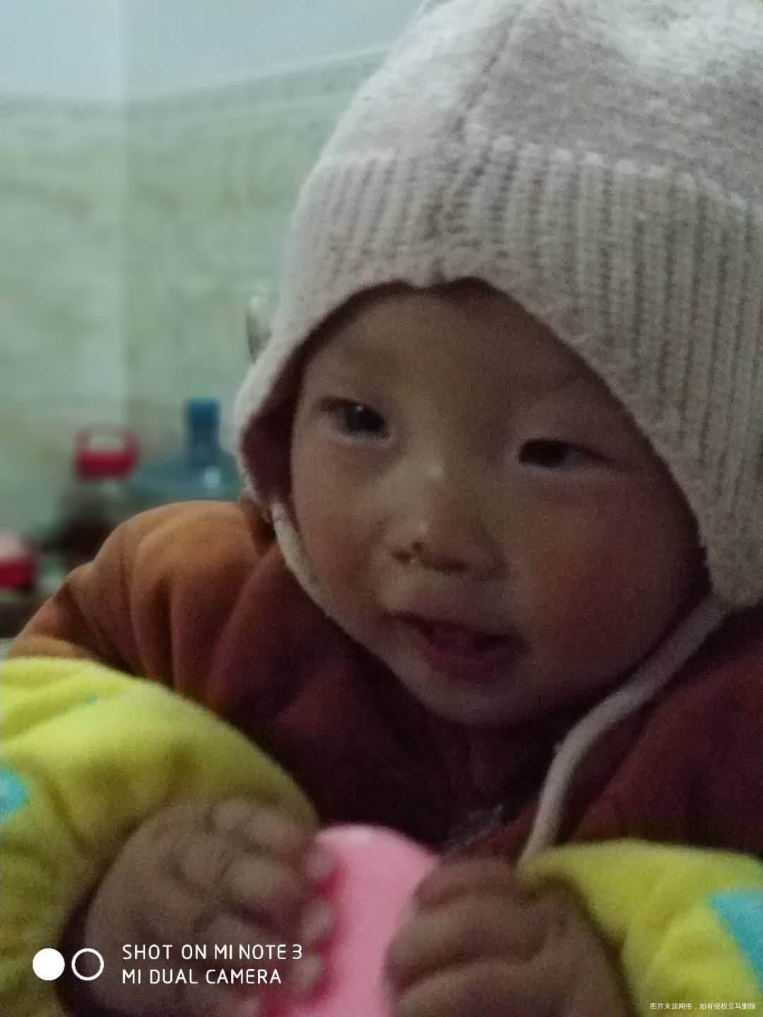 我家宝宝眼睛大小不一样!